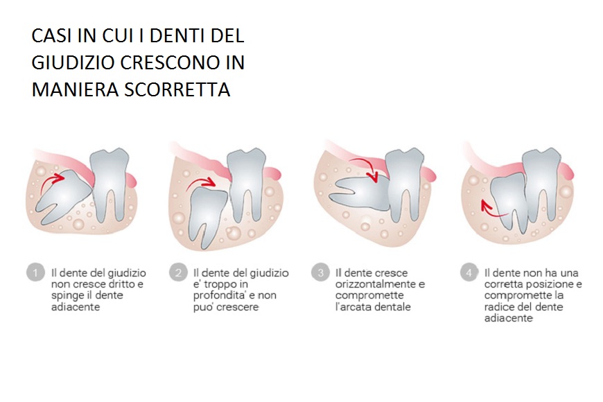 Denti del giudizio2