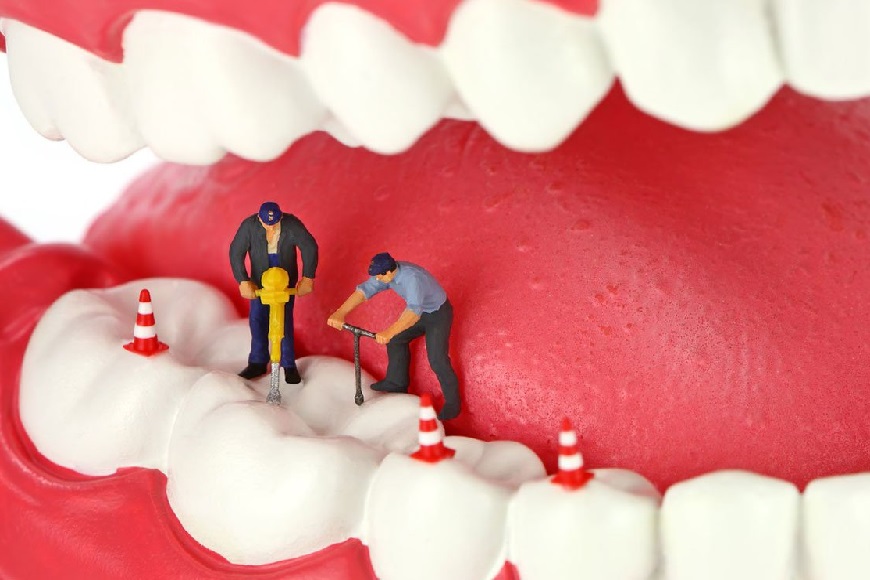 Odontoiatria conservativa5